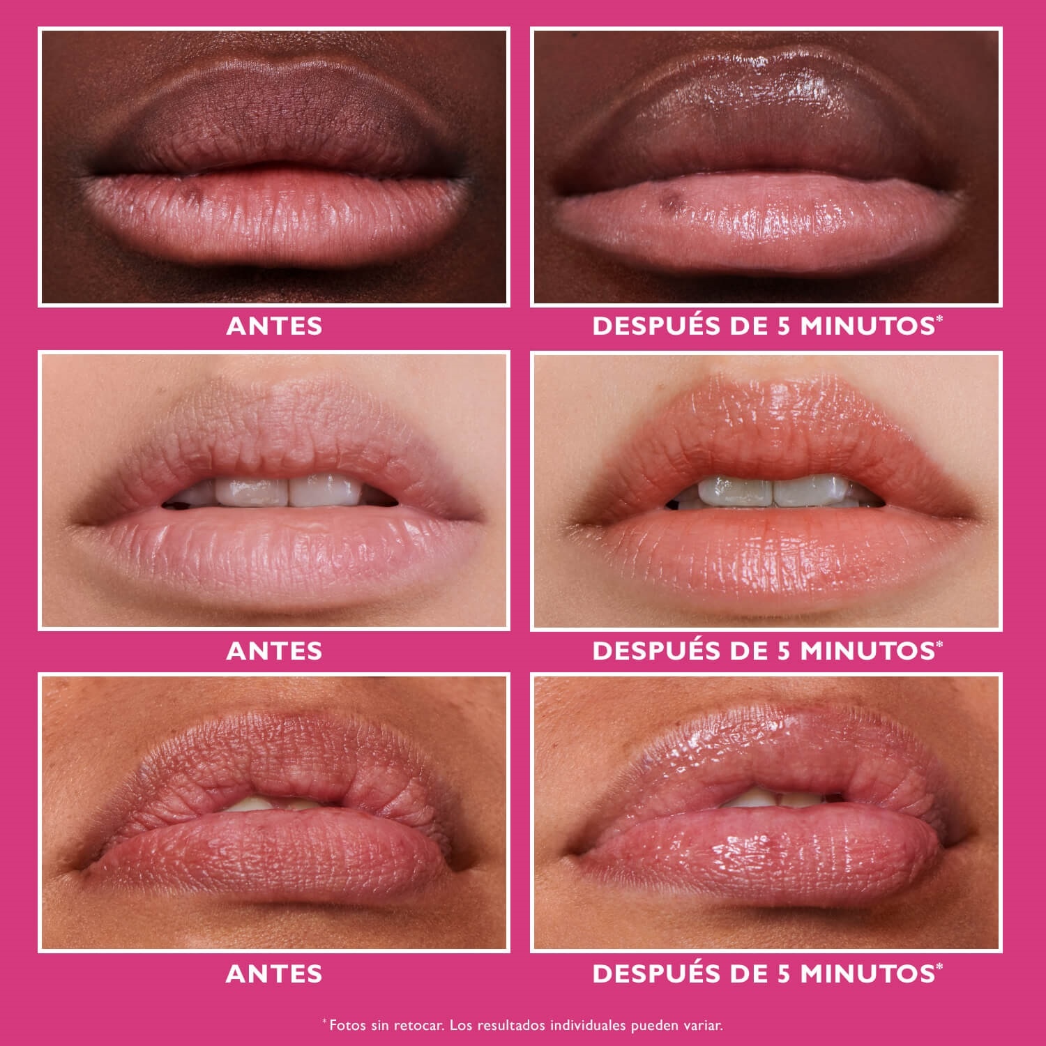 INSTANT FIRMX® LIP FILLER (TRATAMIENTO PARA LABIOS)